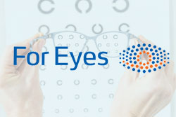 [Podcast] For Eyes’ Vision for Customer Loyalty in Optical Retail: Part I